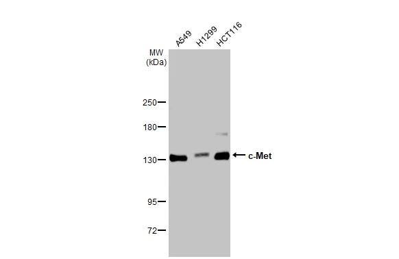 Various whole cell extracts (30 ug) were separated by 5% SDS-PAGE, and the membrane was blotted with c-Met antibody [GT556] (NBP2-43641) diluted at 1:1000. The HRP-conjugated anti-mouse IgG antibody  was used to detect the primary antibody. 