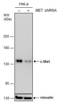 <b>Genetic Strategies Validation. </b>Non-transfected (-) and transfected (+) HeLa whole cell extracts (30 ug) were separated by 5% SDS-PAGE, and the membrane was blotted with c-Met antibody [GT556] (NBP2-43641) diluted at 1:500. 