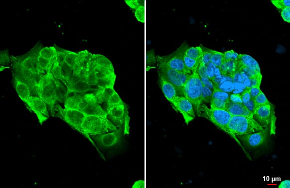 Immunocytochemistry/ Immunofluorescence: NKG2D/CD314 Antibody [NBP2-43645] - NKG2D/CD314 antibody [N3C2], Internal detects NKG2D/CD314 protein at cell membrane by immunofluorescent analysis.Sample: HepG2 cells were fixed in 4% paraformaldehyde at RT for 15 min.Green: NKG2D/CD314 stained by NKG2D/CD314 antibody [N3C2], Internal (NBP2-43645) diluted at 1:500.Blue: Fluoroshield with DAPI .Scale bar= 10um.