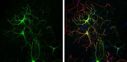 Glutamine synthetase antibody [GT1055] detects Glutamine synthetase protein at cytoplasm by immunofluorescent analysis.Sample: Cultured rat E18 primary cortical neuron, DIV 8. Cells were fixed in 4% paraformaldehyde at RT for 15 min.Green: Glutamine synthetase protein stained by Glutamine synthetase antibody [GT1055] (NBP2-43646) diluted at 1:250.Red: GFAP, stained by GFAP antibody  diluted at 1:250.Blue: Fluoroshield with DAPI . 