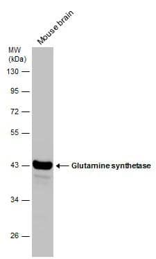 Mouse tissue extract (50 ug) was separated by 10% SDS-PAGE, and the membrane was blotted with Glutamine synthetase antibody [GT1055] (NBP2-43646) diluted at 1:5000. 