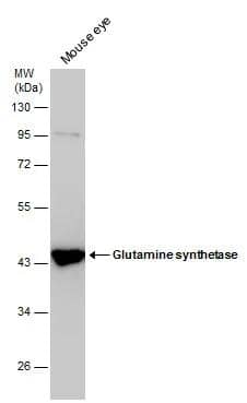 Mouse tissue extract (50 ug) was separated by 10% SDS-PAGE, and the membrane was blotted with Glutamine synthetase antibody (NBP2-43646) diluted at 1:1000. 