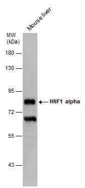 Mouse tissue extract (50 ug) was separated by 7.5% SDS-PAGE, and the membrane was blotted with HNF1 alpha antibody [GT4110] (NBP2-43652) diluted at 1:2000. The HRP-conjugated anti-mouse IgG antibody  was used to detect the primary antibody, and the signal was developed with Trident ECL plus-Enhanced. 