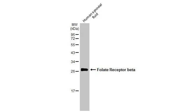 Western Blot: FOLR2 Antibody [NBP2-43654] - Human synovial fluid (50 ug) was separated by 12% SDS-PAGE, and the membrane was blotted with FOLR2 antibody (NBP2-43654) diluted at 1:1000. The HRP-conjugated anti-rabbit IgG antibody  was used to detect the primary antibody.