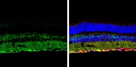 SQSTM1 antibody [GT1478] detects SQSTM1 protein expression by immunohistochemical analysis.Sample: Frozen sectioned adult mouse retina. Green: SQSTM1 protein stained by SQSTM1 antibody [GT1478] (NBP2-43663) diluted at 1:250.Red: beta Tubulin 3/ TUJ1, stained by beta Tubulin 3/ TUJ1 antibody [GT11710]  diluted at 1:250.Blue: Fluoroshield with DAPI . 