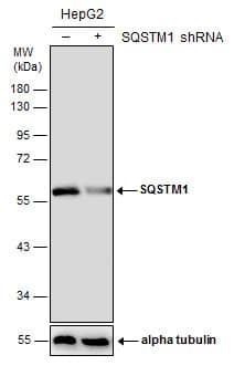 <b>Genetic Strategies Validation. </b>Non-transfected (-) and transfected (+) HepG2 whole cell extracts (50 ug) were separated by 10% SDS-PAGE, and the membrane was blotted with SQSTM1 antibody [GT1478] (NBP2-43663) diluted at 1:500. The HRP-conjugated anti-mouse IgG antibody  was used to detect the primary antibody. 