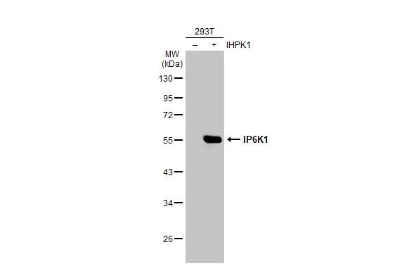 Western Blot: IP6K1 Antibody (10611) [NBP2-43667] - Non-transfected (-) and transfected (+) 293T whole cell extracts (30 ug) were separated by 10% SDS-PAGE, and the membrane was blotted with IP6K1 antibody [GT10611] (NBP2-43667) diluted at 1:20000. The HRP-conjugated anti-mouse IgG antibody  was used to detect the primary antibody.