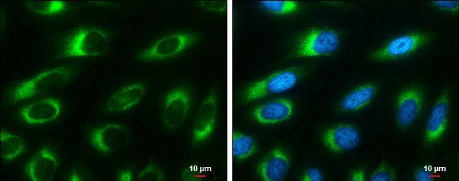 Ribosome binding protein 1 antibody [GT1611] detects Ribosome binding protein 1 protein at endoplasmic reticulum by immunofluorescent analysis.Sample: HeLa cells were fixed in 4% paraformaldehyde at RT for 15 min.Green: Ribosome binding protein 1 stained by Ribosome binding protein 1 antibody [GT1611] (NBP2-43668) diluted at 1:500.Blue: Hoechst 33342 staining.Scale bar= 10um. 