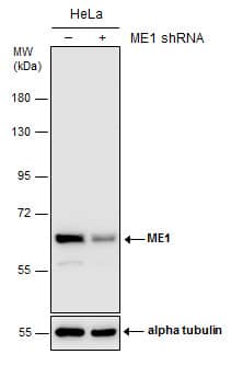 <b>Genetic Strategies Validation. </b>Non-transfected (-) and transfected (+) HeLa whole cell extracts (30 ug) were separated by 7.5% SDS-PAGE, and the membrane was blotted with ME1 antibody [GT15611] (NBP2-43669) diluted at 1:1000. 