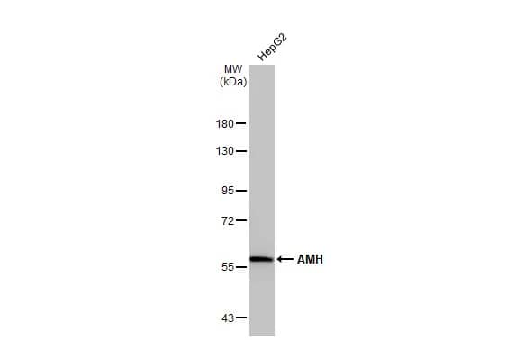 Western Blot: MIS/AMH Antibody [NBP2-43670] - Whole cell extract (30 ug) was separated by 7.5% SDS-PAGE, and the membrane was blotted with MIS/AMH antibody (NBP2-43670) diluted at 1:2500. The HRP-conjugated anti-rabbit IgG antibody  was used to detect the primary antibody.