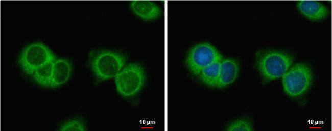 AMH antibody detects AMH protein at cytoplasm by immunofluorescent analysis.Sample: MCF-7 cells were fixed in ice-cold MeOH for 5 min.Green: AMH protein stained by AMH antibody (NBP2-43670) diluted at 1:500.Blue: Hoechst 33342 staining. 