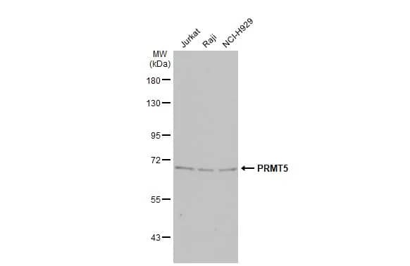 Western Blot: PRMT5 Antibody (3610) [NBP2-43678] - Various whole cell extracts (30 ug) were separated by 7.5% SDS-PAGE, and the membrane was blotted with PRMT5 antibody [GT3610] (NBP2-43678) diluted at 1:1000. The HRP-conjugated anti-mouse IgG antibody  was used to detect the primary antibody, and the signal was developed with Trident ECL plus-Enhanced.