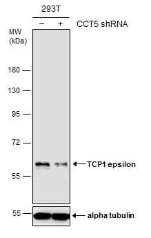 <b>Genetic Strategies Validation. </b>Non-transfected (-) and transfected (+) 293T whole cell extracts (30 ug) were separated by 7.5% SDS-PAGE, and the membrane was blotted with TCP1 epsilon antibody [GT639] (NBP2-43680) diluted at 1:1000. 