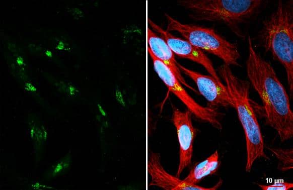 Immunocytochemistry/ Immunofluorescence BICD2 Antibody (10811) - Azide and BSA Free