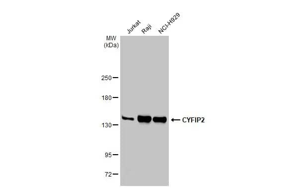 Western Blot CYFIP2 Antibody