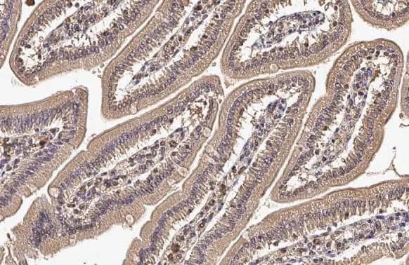 Immunohistochemistry-Paraffin CYFIP2 Antibody