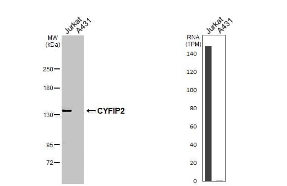 Various whole cell extracts (30 ug) were separated by 5% SDS-PAGE, and the membrane was blotted with CYFIP2 antibody [N2C1], Internal (NBP2-43685) diluted at 1:10000. The HRP-conjugated anti-rabbit IgG antibody  was used to detect the primary antibody. Corresponding RNA expression data for the same cell lines are based on Human Protein Atlas program. 