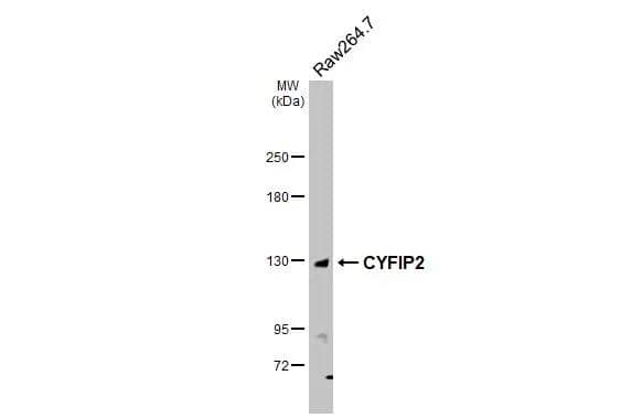 Whole cell extract (30 ug) was separated by 5% SDS-PAGE, and the membrane was blotted with CYFIP2 antibody [N2C1], Internal (NBP2-43685) diluted at 1:1000. The HRP-conjugated anti-rabbit IgG antibody  was used to detect the primary antibody. 