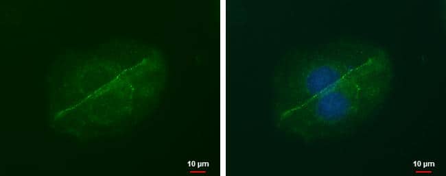 LIN7A antibody [GT879] detects LIN7A protein at junction by immunofluorescent analysis.Sample: MCF-7 cells were fixed in ice-cold MeOH for 5 min.Green: LIN7A protein stained by LIN7A antibody [GT879] (NBP2-43695) diluted at 1:500.Blue: Hoechst 33342 staining. 