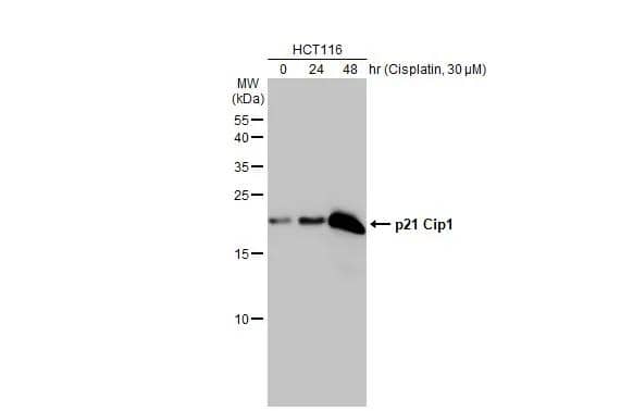 Untreated (-) and treated (+) HCT 116 whole cell extracts (30 ug) were separated by 15% SDS-PAGE, and the membrane was blotted with p21 Cip1 antibody [GT1032] (NBP2-43697) diluted at 1:1000. The HRP-conjugated anti-mouse IgG antibody  was used to detect the primary antibody. 