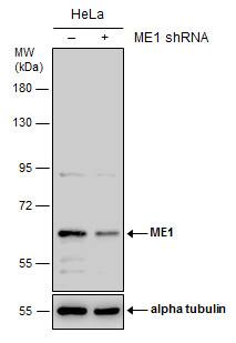 <b>Genetic Strategies Validation. </b>Non-transfected (-) and transfected (+) HeLa whole cell extracts (30 ug) were separated by 7.5% SDS-PAGE, and the membrane was blotted with ME1 antibody [GT736] (NBP2-43709) diluted at 1:500. 