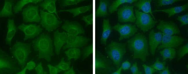ME1 antibody [GT979] detects ME1 protein at cytoplasm by immunofluorescent analysis.Sample: HeLa cells were fixed in 4% paraformaldehyde at RT for 15 min.Green: ME1 protein stained by ME1 antibody [GT979] (NBP2-43710) diluted at 1:400.Blue: Hoechst 33342 staining. 