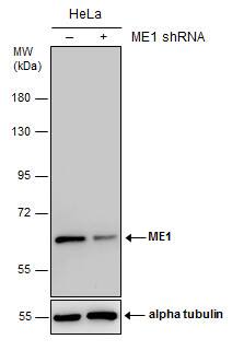 <b>Genetic Strategies Validation. </b>Non-transfected (-) and transfected (+) HeLa whole cell extracts (30 ug) were separated by 7.5% SDS-PAGE, and the membrane was blotted with ME1 antibody [GT979] (NBP2-43710) diluted at 1:1000. 
