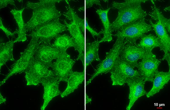 Immunocytochemistry/ Immunofluorescence: PNPT1 Antibody (4C11) [NBP2-43725] - PNPT1 antibody [4C11] detects PNPT1 protein at cell junction by immunofluorescent analysis.Sample: HeLa cells were fixed in 4% paraformaldehyde at RT for 15 min.Green: PNPT1 stained by PNPT1 antibody [4C11] (NBP2-43725) diluted at 1:500.Blue: Fluoroshield with DAPI .Scale bar= 10um.