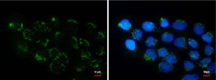 Immunocytochemistry/ Immunofluorescence Collagen XI alpha 2 Antibody (473) - Azide and BSA Free