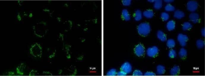 COL11A2 antibody [GT473] detects COL11A2 protein at cytoplasm by immunofluorescent analysis.Sample: A431 cells were fixed in ice-cold MeOH for 5 min.Green: COL11A2 protein stained by COL11A2 antibody [GT473] (NBP2-43728) diluted at 1:500.Blue: Hoechst 33342 staining. 
