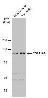 Western Blot Collagen XI alpha 2 Antibody (473) - Azide and BSA Free