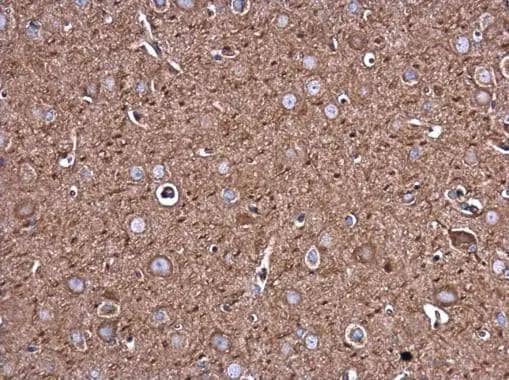 Filamin B antibody [GT1372] detects Filamin B protein at cytoplasm in rat brain by immunohistochemical analysis. Sample: Paraffin-embedded rat brain. Filamin B antibody [GT1372] (NBP2-43732) diluted at 1:250. Antigen Retrieval: Citrate buffer, pH 6.0, 15 min 
