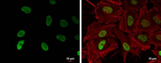 <b>Biological Strategies Validation. </b>Histone H3K9ac (acetyl Lys9) antibody [GT464] detects Histone H3K9ac (acetyl Lys9) protein at nucleus by immunofluorescent analysis.Sample: HeLa cells were fixed in 4% paraformaldehyde at RT for 15 min.Green: Histone H3K9ac (acetyl Lys9) protein stained by Histone H3K9ac (acetyl Lys9) antibody [GT464] (NBP2-43733) diluted at 1:500.Red: phalloidin, a cytoskeleton marker, diluted at 1:200.Blue: Hoechst 33342 staining.Scale bar = 10 um. 