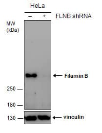 <b>Genetic Strategies Validation. </b>Non-transfected (-) and transfected (+) HeLa whole cell extracts (30 ug) were separated by 5% SDS-PAGE, and the membrane was blotted with Filamin B antibody [GT387] (NBP2-43740) diluted at 1:500. 