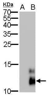 Pancreatic polypeptide antibody [GT6512] detects PPY protein by Western blot analysis.A. 30 ug 293T whole cell lysate/extract B. 30 ug whole cell lysate/extract of human PPY-transfected 293T cells15 % SDS-PAGEPancreatic polypeptide antibody [GT6512] (NBP2-43741) dilution: 1:5000 
