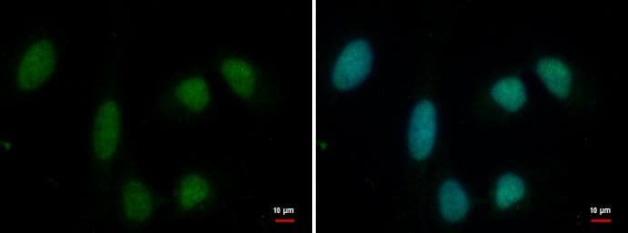 Immunocytochemistry/ Immunofluorescence PRMT1 Antibody (779) - Azide and BSA Free