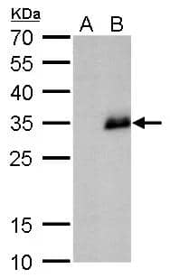 Neurogenin 1 antibody detects Neurogenin 1 protein by western blot analysis.A 293T whole cell lysate/extractB of human NEUROG1-transfected 293T cells12 % SDS-PAGENeurogenin 1 antibody (NBP2-43749) dilution: 1:1000 