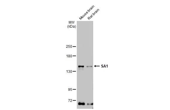 Western Blot: SA1 Antibody (1515) [NBP2-43751] - Various tissue extracts (50 ug) were separated by 5% SDS-PAGE, and the membrane was blotted with SA1 antibody [GT1515] (NBP2-43751) diluted at 1:1000. The HRP-conjugated anti-mouse IgG antibody  was used to detect the primary antibody.