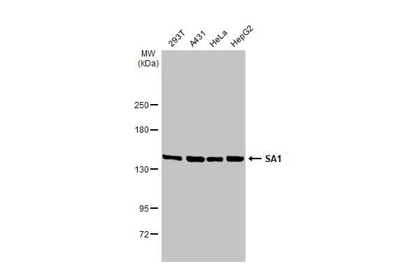 Western Blot: SA1 Antibody (1515) [NBP2-43751] - Various whole cell extracts (30 ug) were separated by 5% SDS-PAGE, and the membrane was blotted with SA1 antibody [GT1515] (NBP2-43751) diluted at 1:1000. The HRP-conjugated anti-mouse IgG antibody  was used to detect the primary antibody.