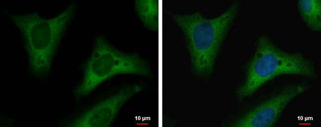 Triosephosphate isomerase antibody [GT181] detects Triosephosphate isomerase protein at cytoplasm by immunofluorescent analysis.Sample: HeLa cells were fixed in 4% paraformaldehyde at RT for 15 min.Green: Triosephosphate isomerase protein stained by Triosephosphate isomerase antibody [GT181] (NBP2-43761) diluted at 1:200.Blue: Hoechst 33342 staining.Scale bar = 10 um. 