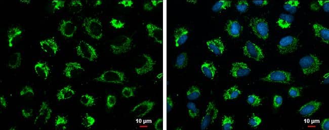 Immunocytochemistry/ Immunofluorescence Glutaminase Antibody (3211) - Azide and BSA Free