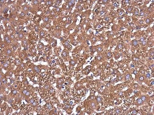 Immunohistochemistry-Paraffin Glutaminase Antibody (3211) - Azide and BSA Free
