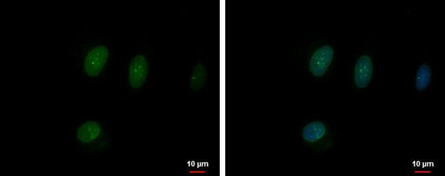 Immunocytochemistry/ Immunofluorescence TFEC Antibody - BSA Free