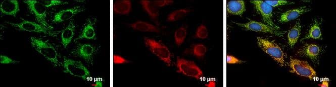 FIS1 antibody detects FIS1 protein at mitochondria by immunofluorescent analysis.Sample: HeLa cells were fixed in 2% paraformaldehyde/culture medium at 37oC for 30 min.Green: FIS1 protein stained by FIS1 antibody (NBP2-43771) diluted at 1:1000.Red: MitoTrackerR Red CMXRos, a mitochondria tracker.Blue: Hoechst 33342 staining.Scale bar = 10 um. 