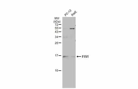 Various whole cell extracts (30 ug) were separated by 15% SDS-PAGE, and the membrane was blotted with FIS1 antibody [GT4211] (NBP2-43771) diluted at 1:500. The HRP-conjugated anti-mouse IgG antibody  was used to detect the primary antibody. 
