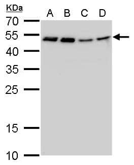 CFDP1 antibody [GT11811] detects CFDP1 protein by western blot analysis.A U87-MG whole cell lysate/extractB SK-N-SH whole cell lysate/extract C IMR32 whole cell lysate/extractD SK-N-AS whole cell lysate/extract12 % SDS-PAGECFDP1 antibody [GT11811] (NBP2-43772) dilution: 1:1000 