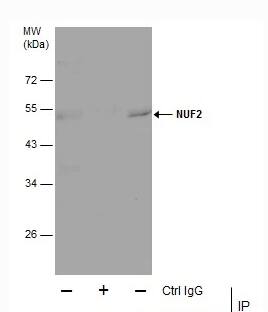 NUF2 protein from HeLa whole cell extracts using 5 μg of NUF2 antibody [GT312] .Western blot analysis was performed using NUF2 antibody [GT312] diluted at 1:500.EasyBlot anti-Mouse IgG was used as a secondary reagent.