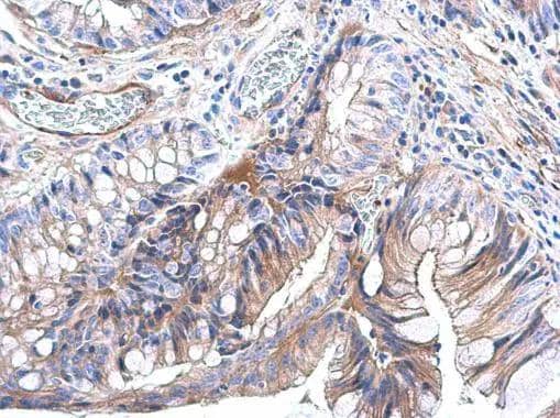 Immunohistochemistry-Paraffin Ras Antibody