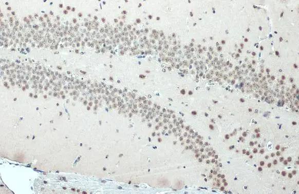 Immunohistochemistry-Paraffin SNRPE Antibody