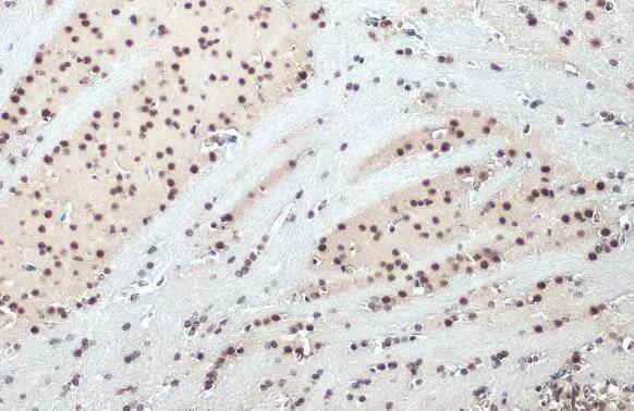 Immunohistochemistry-Paraffin SNRPE Antibody
